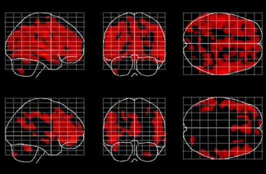 What These Brain Changes Mean